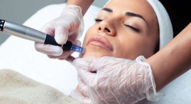 Dermapen tratamiento facial madrid